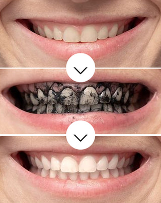 Избелваща пудра за зъби с кокосов въглен Smilebite - 4
